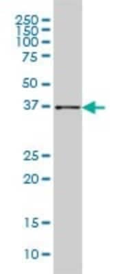 Western Blot: Aldo-keto Reductase 1B10/AKR1B10 Antibody (1A6) [H00057016-M01]