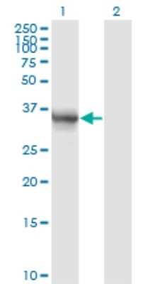 Western Blot: Aldo-keto Reductase 1B10/AKR1B10 Antibody (1A6) [H00057016-M01]