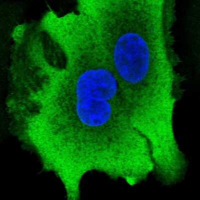 Immunocytochemistry/ Immunofluorescence: Aldo-keto Reductase 1B10/AKR1B10 Antibody [NBP2-57972]