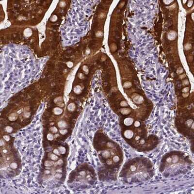 Immunohistochemistry-Paraffin: Aldo-keto Reductase 1B10/AKR1B10 Antibody [NBP1-89161]