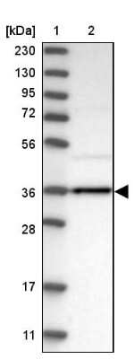 Western Blot: Aldo-keto Reductase 1B10/AKR1B10 Antibody [NBP1-89161]