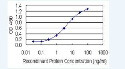 ELISA: Aldo-keto Reductase 1C1/AKR1C1 Antibody (1B3) [H00001645-M01-100ug]