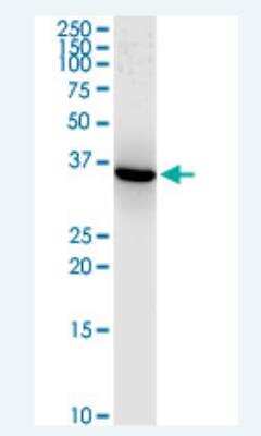 Western Blot: Aldo-keto Reductase 1C1/AKR1C1 Antibody (1B3) [H00001645-M01-100ug]