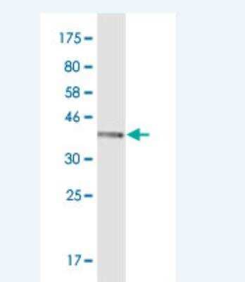 Western Blot: Aldo-keto Reductase 1C1/AKR1C1 Antibody (1B3) [H00001645-M01-100ug]