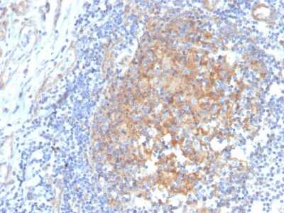 Immunohistochemistry-Paraffin: Aldo-keto Reductase 1C1/AKR1C1 Antibody (CPTC-AKR1C1-2) - Azide and BSA Free [NBP3-08655]