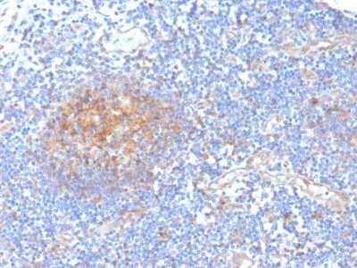 Immunohistochemistry-Paraffin: Aldo-keto Reductase 1C1/AKR1C1 Antibody (CPTC-AKR1C1-2) - Azide and BSA Free [NBP3-08655]