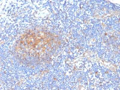 Immunohistochemistry-Paraffin: Aldo-keto Reductase 1C1/AKR1C1 Antibody (CPTC-AKR1C1-2) [NBP3-07639]