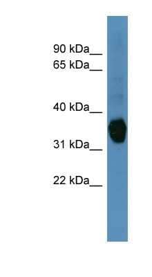 Western Blot: Aldo-keto Reductase 1C1/AKR1C1 Antibody [NBP1-68877]