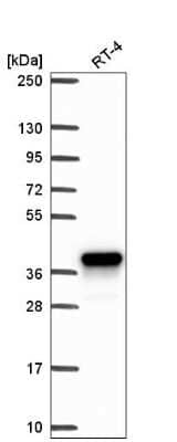 Western Blot: Aldo-keto Reductase 1C1/AKR1C1 Antibody [NBP2-57667]