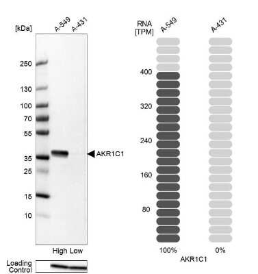 Western Blot: Aldo-keto Reductase 1C1/AKR1C1 Antibody [NBP2-57667]