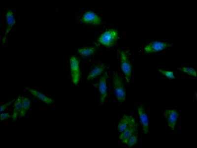 Immunocytochemistry/ Immunofluorescence: Aldo-keto Reductase 1C3/AKR1C3 Antibody (4D12) [NBP3-15212]