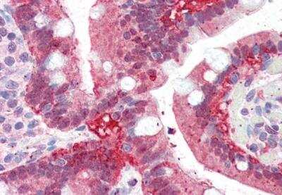 Immunohistochemistry-Paraffin: Aldo-keto Reductase 1C3/AKR1C3 Antibody [NB100-1940]