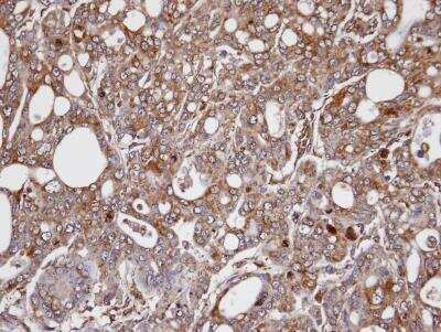 Immunohistochemistry-Paraffin: Aldo-keto Reductase 1C3/AKR1C3 Antibody [NBP1-31378]