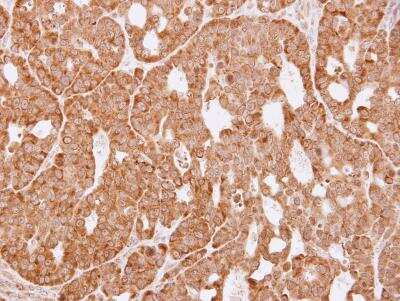 Immunohistochemistry-Paraffin: Aldo-keto Reductase 1C3/AKR1C3 Antibody [NBP1-33556]