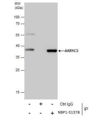 Immunoprecipitation: Aldo-keto Reductase 1C3/AKR1C3 Antibody [NBP1-31378]