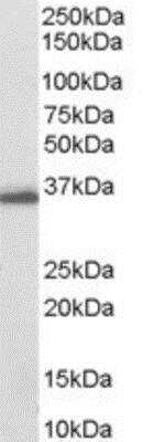 Western Blot: Aldo-keto Reductase 1C3/AKR1C3 Antibody [NB100-1940]