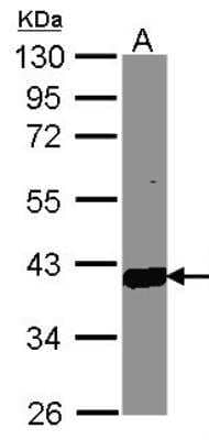 Western Blot: Aldo-keto Reductase 1C3/AKR1C3 Antibody [NBP1-31378]