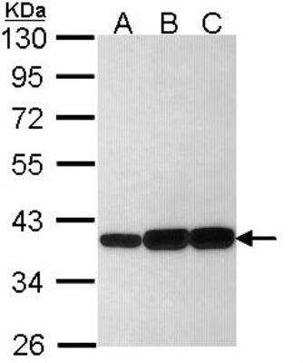 Western Blot: Aldo-keto Reductase 1C3/AKR1C3 Antibody [NBP1-33556]