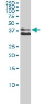 Western Blot: Aldo-keto Reductase 1C4/AKR1C4 Antibody (2C11) [H00001109-M01]