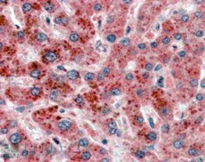 Immunohistochemistry-Paraffin: Aldo-keto Reductase 1C4/AKR1C4 Antibody [NB100-40786]