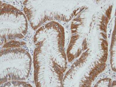 Immunohistochemistry-Paraffin: Aldo-keto Reductase 1C4/AKR1C4 Antibody [NBP1-31429]