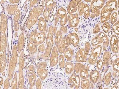 Immunohistochemistry-Paraffin: Aldo-keto Reductase 1C4/AKR1C4 Antibody [NBP2-97581]