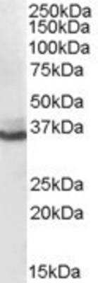 Western Blot: Aldo-keto Reductase 1C4/AKR1C4 Antibody [NB100-40786]