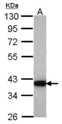 Western Blot: Aldo-keto Reductase 1C4/AKR1C4 Antibody [NBP1-31429]