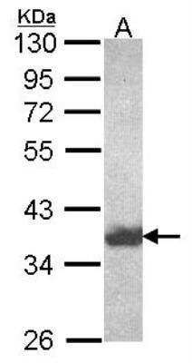 Western Blot: Aldo-keto Reductase 1C4/AKR1C4 Antibody [NBP2-14989]