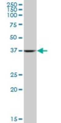 Western Blot: Aldolase A Antibody (2E6) [H00000226-M03]