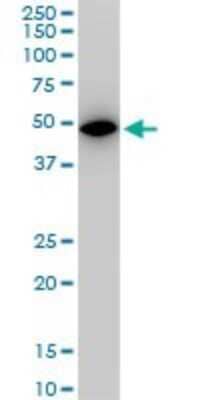 Western Blot: Aldolase A Antibody (2E6) [H00000226-M03]