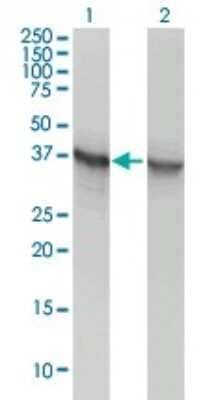 Western Blot: Aldolase A Antibody (3C12-6D11) [H00000226-M02]