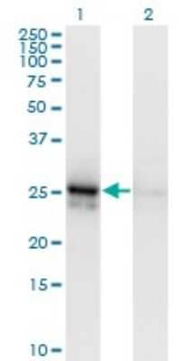 Western Blot: Aldolase A Antibody (3D9-6F3) [H00000226-M01]