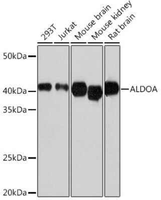 Western Blot: Aldolase A Antibody (4B2E5) [NBP3-15381]