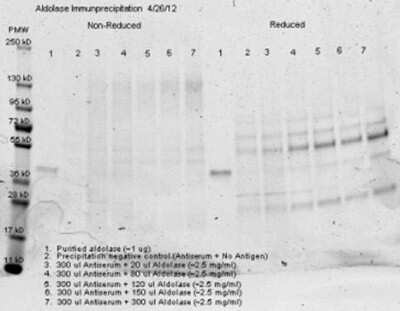 Immunoprecipitation: Aldolase A Antibody [NB600-915]