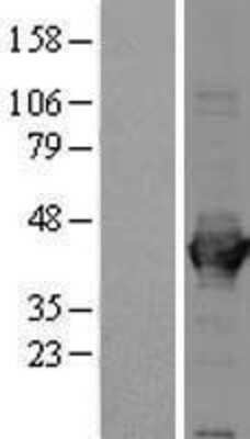 Western Blot: Aldolase A Overexpression Lysate [NBL1-07459]