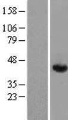 Western Blot: Aldolase A Overexpression Lysate [NBP2-04772]