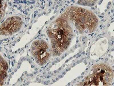Immunohistochemistry-Paraffin: Aldolase B Antibody (OTI3C6) [NBP2-00750]