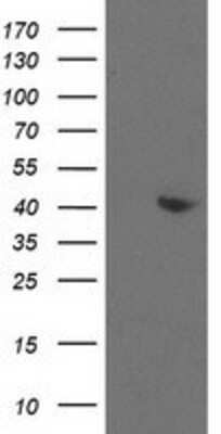 Western Blot: Aldolase B Antibody (OTI3C6) [NBP2-00750]