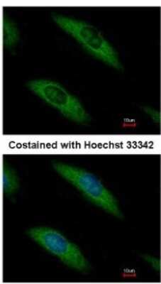 Immunocytochemistry/ Immunofluorescence: Aldolase B Antibody [NBP2-15344]