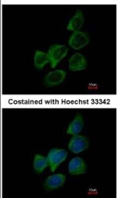 Immunocytochemistry/ Immunofluorescence: Aldolase B Antibody [NBP2-15345]