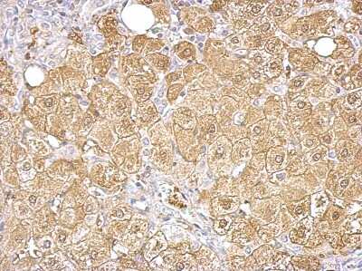 Immunohistochemistry: Aldolase B Antibody [NBP2-15344]