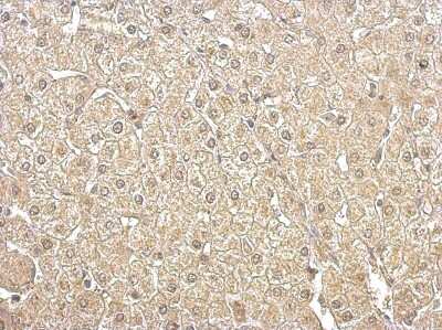 Immunohistochemistry-Paraffin: Aldolase B Antibody [NBP2-15345]