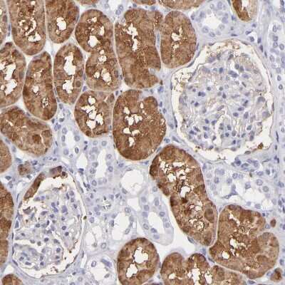 Immunohistochemistry-Paraffin: Aldolase B Antibody [NBP1-87494]