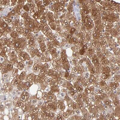 Immunohistochemistry-Paraffin: Aldolase B Antibody [NBP1-87494]