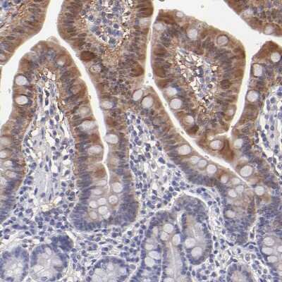 Immunohistochemistry-Paraffin: Aldolase B Antibody [NBP1-87494]