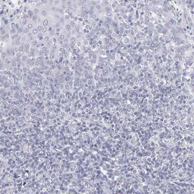 Immunohistochemistry-Paraffin: Aldolase B Antibody [NBP1-87494]