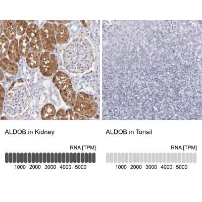 Immunohistochemistry-Paraffin: Aldolase B Antibody [NBP1-87494]