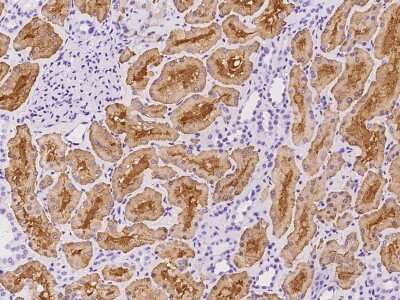 Immunohistochemistry-Paraffin: Aldolase B Antibody [NBP2-97910]