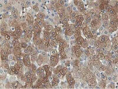 Immunohistochemistry: Aldolase B Antibody (OTI3C6) - Azide and BSA Free [NBP2-70162]